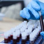 Wissenschaftler identifizieren eine neue Blutgruppe, die als die seltenste der Welt gilt – Sie gehört einer einzigen Frau