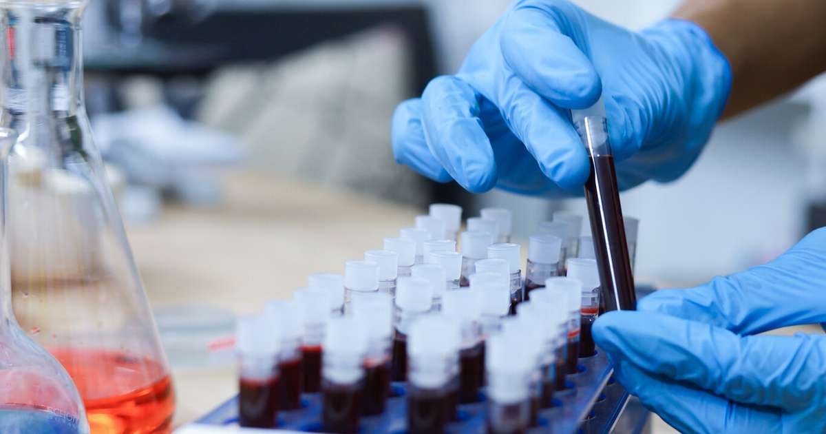 Wissenschaftler identifizieren eine neue Blutgruppe, die als die seltenste der Welt gilt – Sie gehört einer einzigen Frau